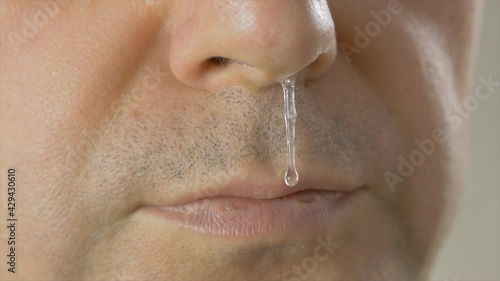 Close-up of an adult man's face with drooping snot from his nose