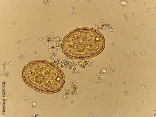 Wallpaper Mural Egg of Ascaris lumbricoides (roundworm) in human stool, analyze by microscope Torontodigital.ca