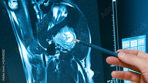 Cropped view of female hand pointing on dog brain sagitalis on MRI image. Examination on veterinary clinic, taking care about domestic animals. 