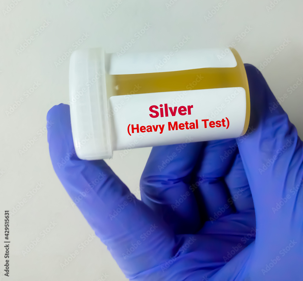 Urine sample for Silver (heavy metal) test, toxic metal. Diagnosis of