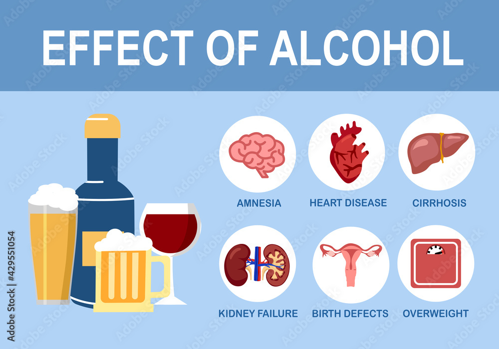 Vecteur Stock Effects of alcohol on human body infographic in flat ...