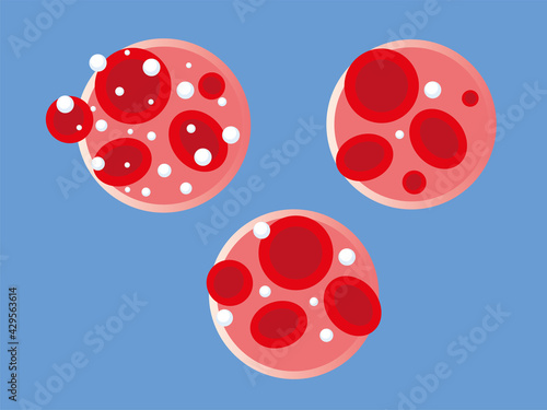 glucose blood level