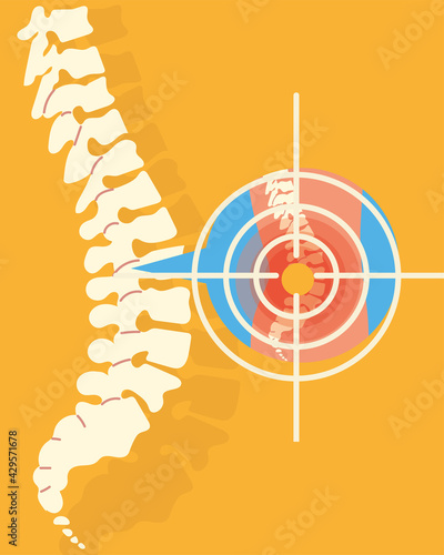 rheumatology spine bones