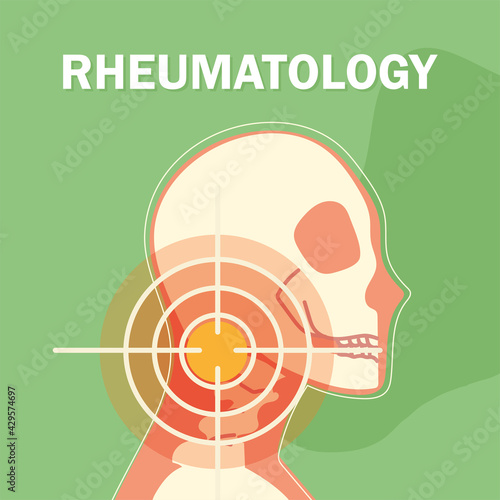 rheumatology head bones