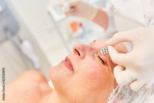 Patient receives eyelid marking for surgery