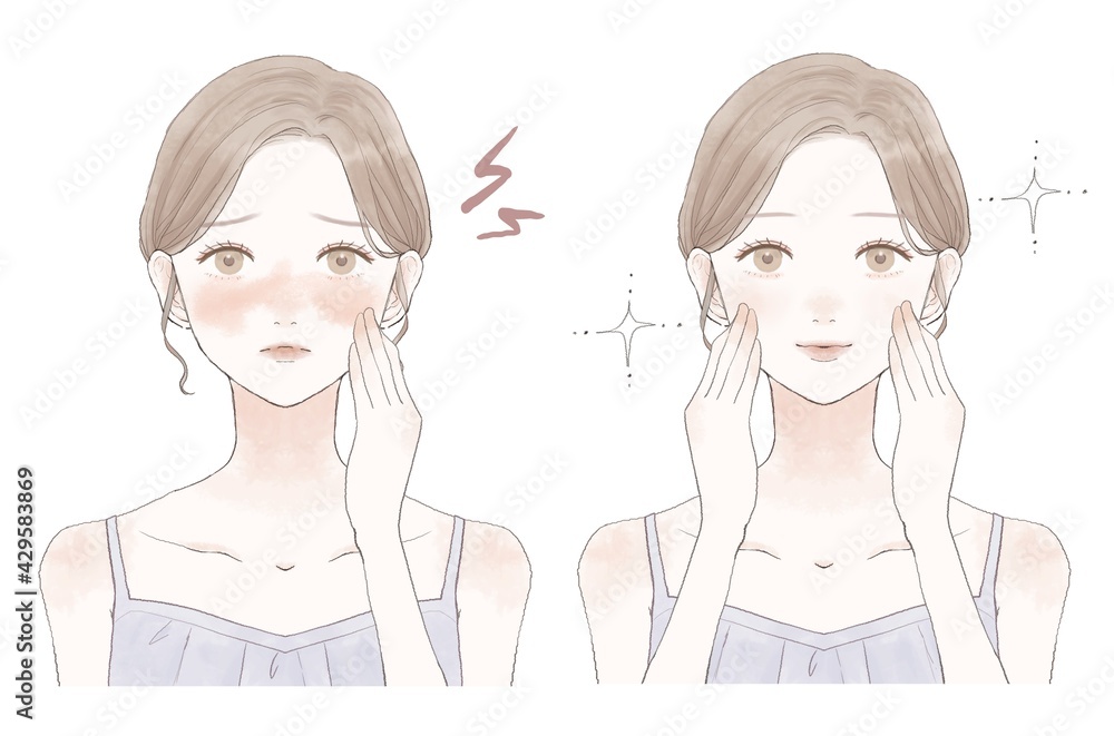 スキンケア　女性　赤み　ビフォーアフター