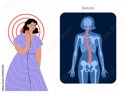 Scoliosis and spine pain