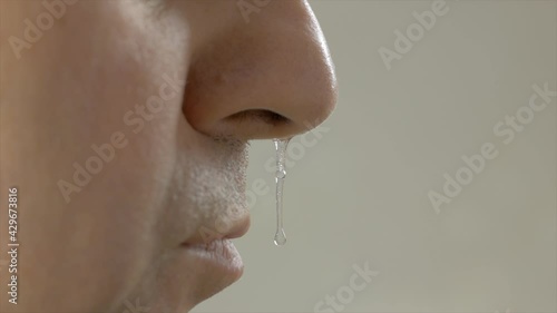 Close-up of an adult man's face with drooping snot from his nose