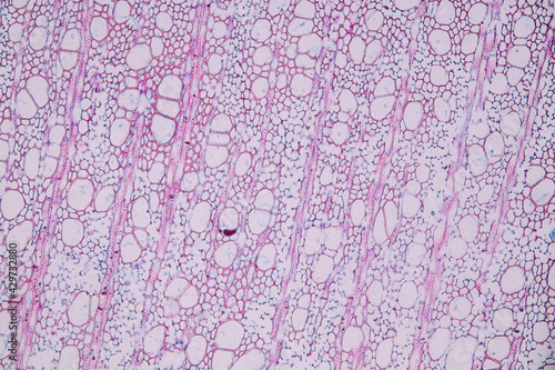 Characteristics of fungi living in wood as a group, are polyphyletic under the microscope for education.
 photo