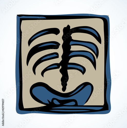 X-ray of the ridge. Vector drawing