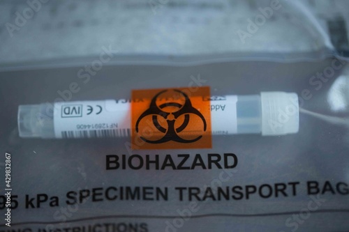 
Biohazard specimen transport bag with a sample
