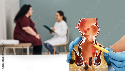 Fotografia Proctologist consultation