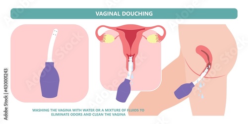 Douche vagina odor clean blood flora ectopic yeast bacterial Pelvic genitals swelling pain sex hygiene system microbes allergic cycle health problem tract prevent mucus Cervical cervix itching cancer