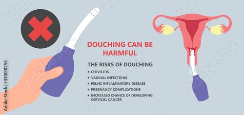 Douche vagina odor clean blood flora ectopic yeast bacterial Pelvic genitals swelling pain sex hygiene system microbes allergic cycle health problem tract prevent mucus Cervical cervix itching cancer