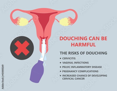 Douche vagina odor clean blood flora ectopic yeast bacterial Pelvic genitals swelling pain sex hygiene system microbes allergic cycle health problem tract prevent mucus Cervical cervix itching cancer