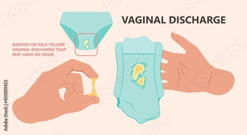 Douche vagina odor clean blood flora ectopic yeast bacterial Pelvic genitals swelling pain sex hygiene system microbes allergic cycle health problem tract prevent mucus Cervical cervix itching cancer