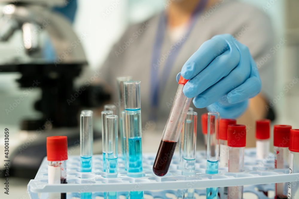 Examining blood sample in laboratory Examining blood sample in laboratory