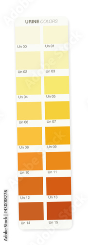 Urine colors. Color stripe with index from clear urine to yellow and orange and even darker. Indicator of the level of dehydration. Vector illustration on white.
