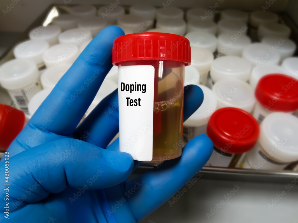 Urine drugs test sample for determine presence of illegal drugs in