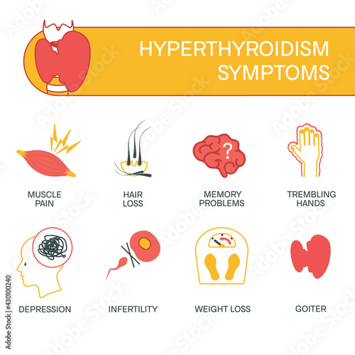 Symptoms of thyroid disorder-goiter, infertility, hair loss. Hyperthyroidism signs infographics. Human endocrine system disease. Medical internal organ. Vector illustration.