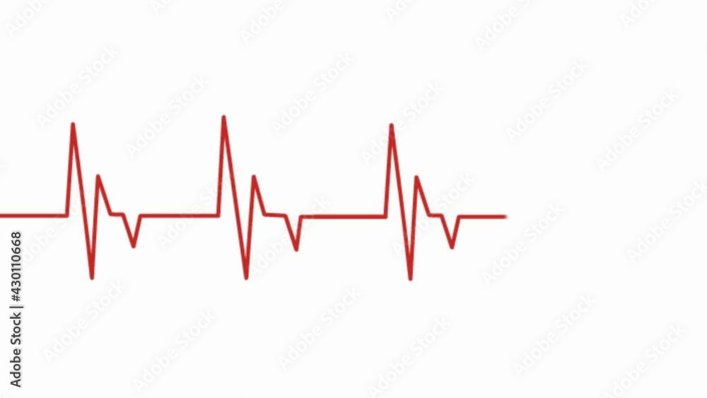 Heart rate monitoring, animated cardiogram.Animated video red scale of the cardiogram of the heart, shows an even rhythm.ECG monitoring. Heart rate monitoring, animated cardiogram.Animated video red scale of the cardiogram of the heart, shows an even rhythm.ECG monitoring.
