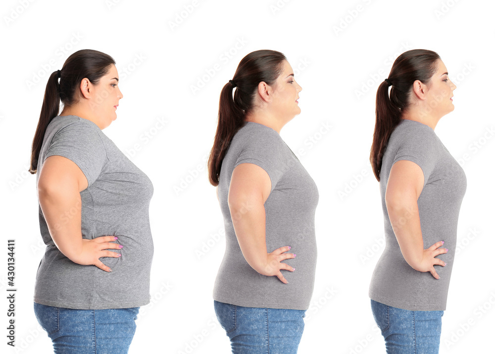 Woman before and after weight loss on white background, collage Woman before and after weight loss on white background, collage