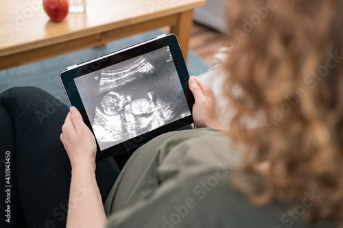 Shot of beautiful young pregnant woman looking ultrasound of her baby on digital tablet while lying on bed.