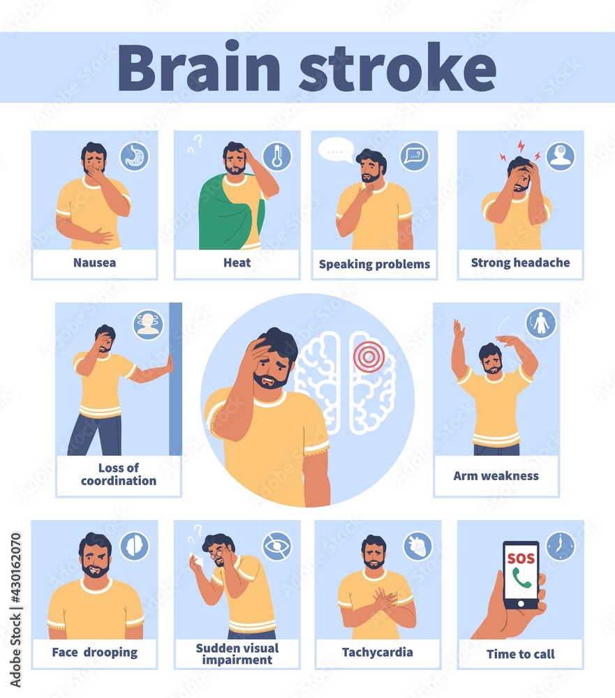 Brain stroke warning signs and symptoms vector medical infographic, poster. Headache, trouble speaking, face drooping. Brain stroke warning signs and symptoms vector medical infographic, poster. Headache, trouble speaking, face drooping.