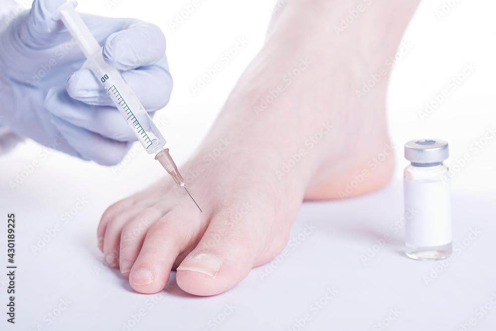 Injection made in the foot