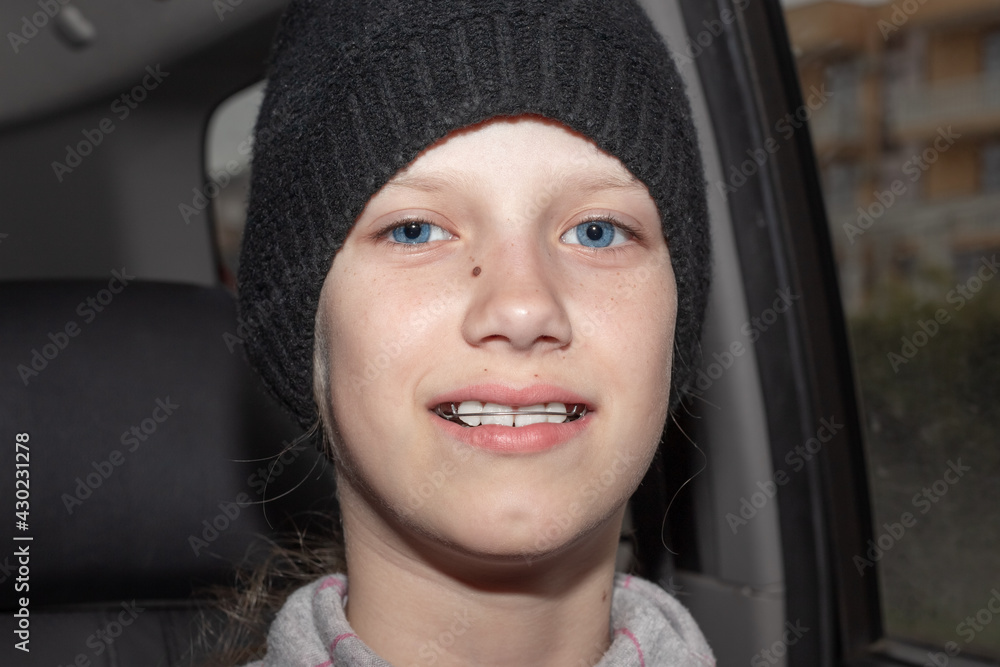 A teenage girl in a black hat with iron braces on her teeth is smiling while sitting in a car salon. Straightening the bite and beauty of the teeth
