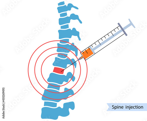 Spine joint injection 