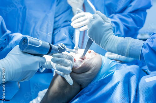 Selective focus with blurred background.Orthopedic surgeon in blue surgical gown suite using saw to cut the bone while total knee replacement surgery in osteoarthritis patient.Team of surgeons. photo