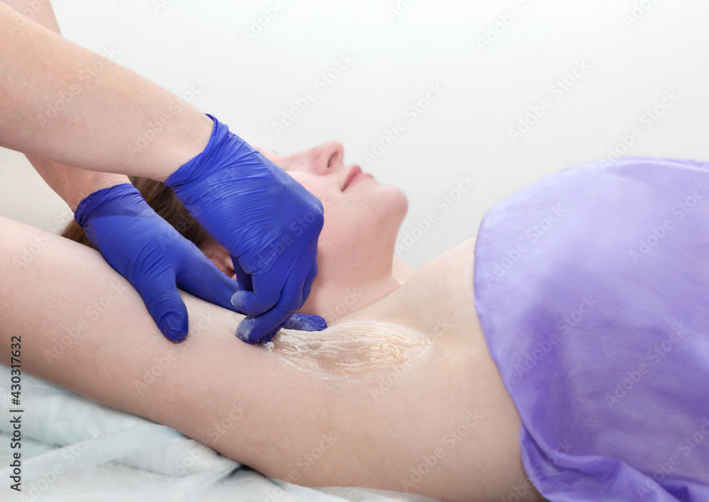 Depilation female armpit with liquid sugar paste. Hand of cosmetologist applying wax paste on armpit.