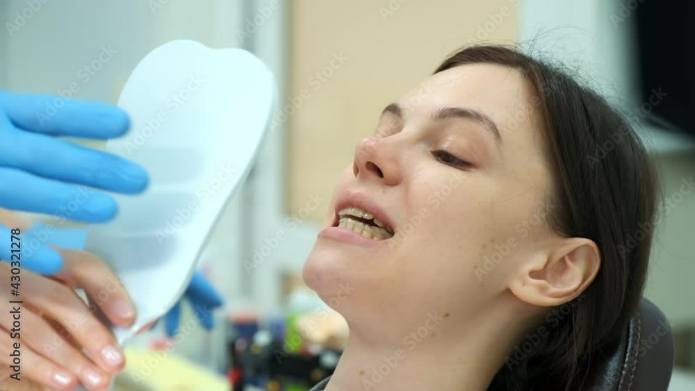 Orthodontist doctor checks the closing of woman teeth with silicone invisible transparent trainer using carbon paper. Portrait of woman in dentistry. Correcting teeth. Oral hygiene, treatment, cure. Orthodontist doctor checks the closing of woman teeth with silicone invisible transparent trainer using carbon paper. Portrait of woman in dentistry. Correcting teeth. Oral hygiene, treatment, cure.