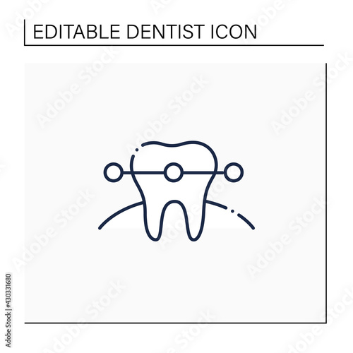 Tooth braces line icon. Tooth care fixed and correct bite and realign teeth over time. Teeth care hygiene concept. Isolated vector illustration. Editable stroke