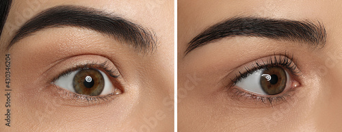 Fotografie, Tablou Collage with photos of woman before and after eyelash lamination procedure, closeup