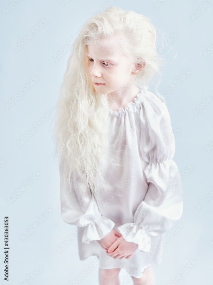 Portrait of a little albino girl