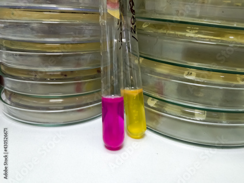 Urea agar base, citrate agar, triple sugar iron agar and motility urea indole medium. Laboratory medicine concept photo