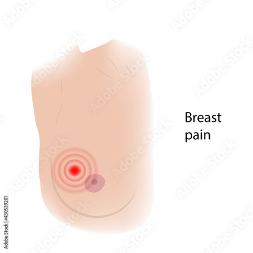 Woman breast pain. Cancer symptoms view with description. Medical vector illustration.