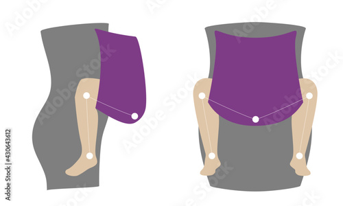 Schematic physiological position of the child in the carrier. M-position for the prevention of hip dysplasia