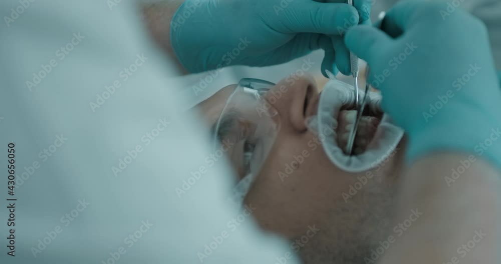 Bite Frame Close-up a male patient is having between of his teeth a bite frame Y ...
