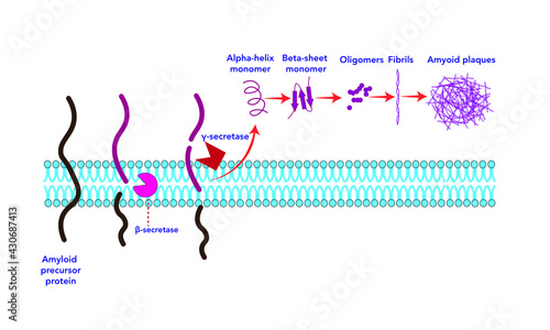Amyloid plaque formation [Alzheimer]