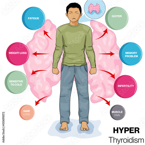 illustration of Symptoms of hyperthyroidism in humans. 