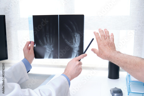 Young doctor examining x-ray of hands of a senior patient with arthritis. Radiography of a hand. photo