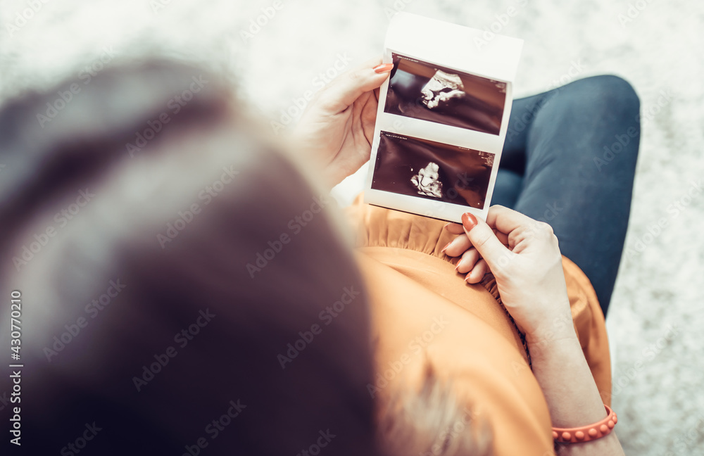 Zdjęcie ciążowe USG - obrazy, fototapety, plakaty 