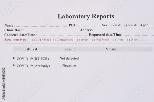 COVID-19 test results by using RT-PCR method and rapid test antibody method, the results showed not detected and negative respectively photo