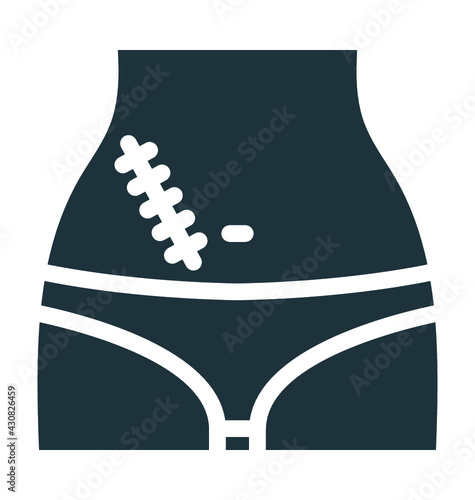 Appendix Surgery