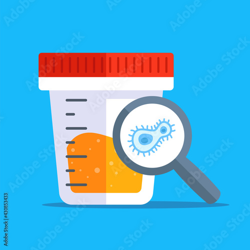 positive result in urine analysis. flat vector illustration.