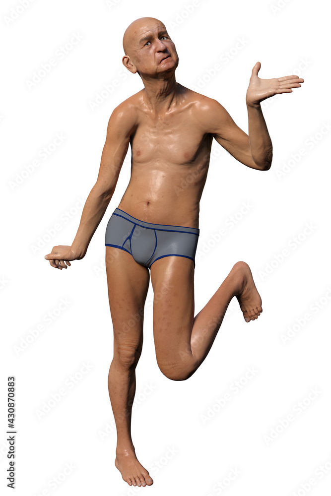 A person with Huntington's chorea, 3D illustration A person with Huntington's chorea, 3D illustration