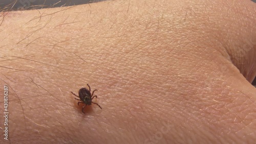 Tick crawling on the skin. High risk of infection with a tick-borne disease such as Lyme disease. photo